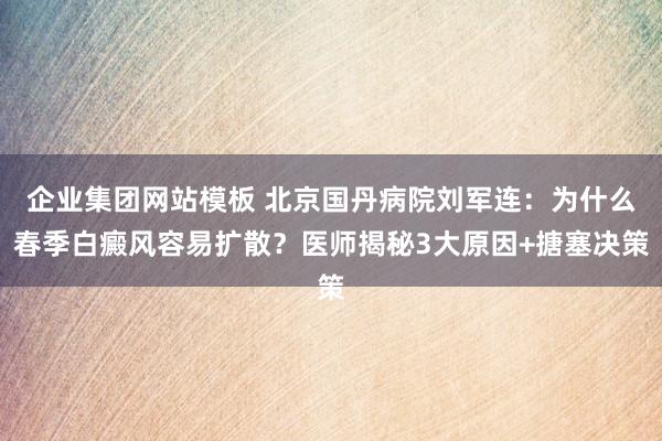 企业集团网站模板 北京国丹病院刘军连：为什么春季白癜风容易扩散？医师揭秘3大原因+搪塞决策