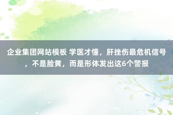 企业集团网站模板 学医才懂，肝挫伤最危机信号，不是脸黄，而是形体发出这6个警报